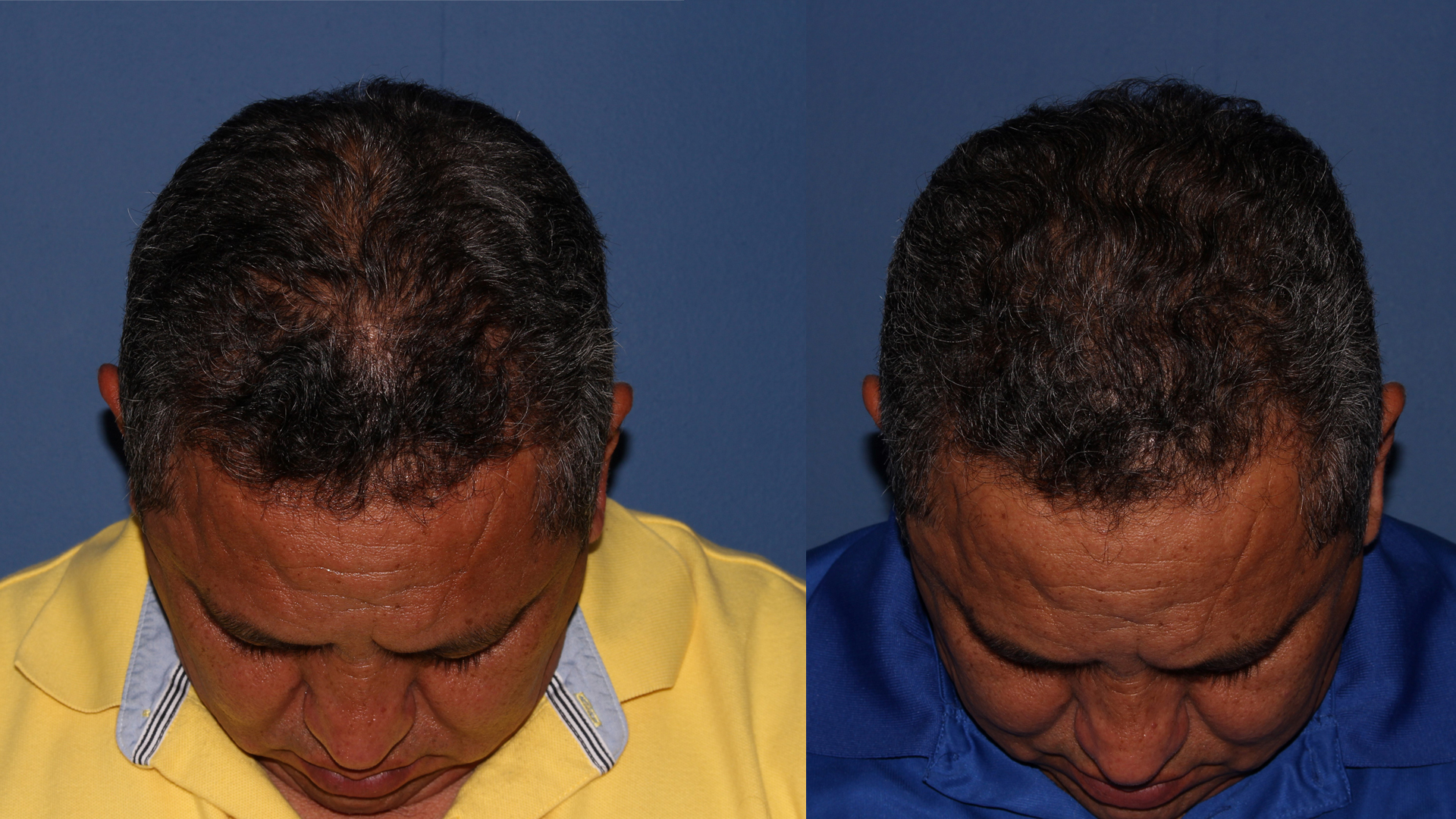 Official Tricovit Hair Care Try All Four Products 99 Free